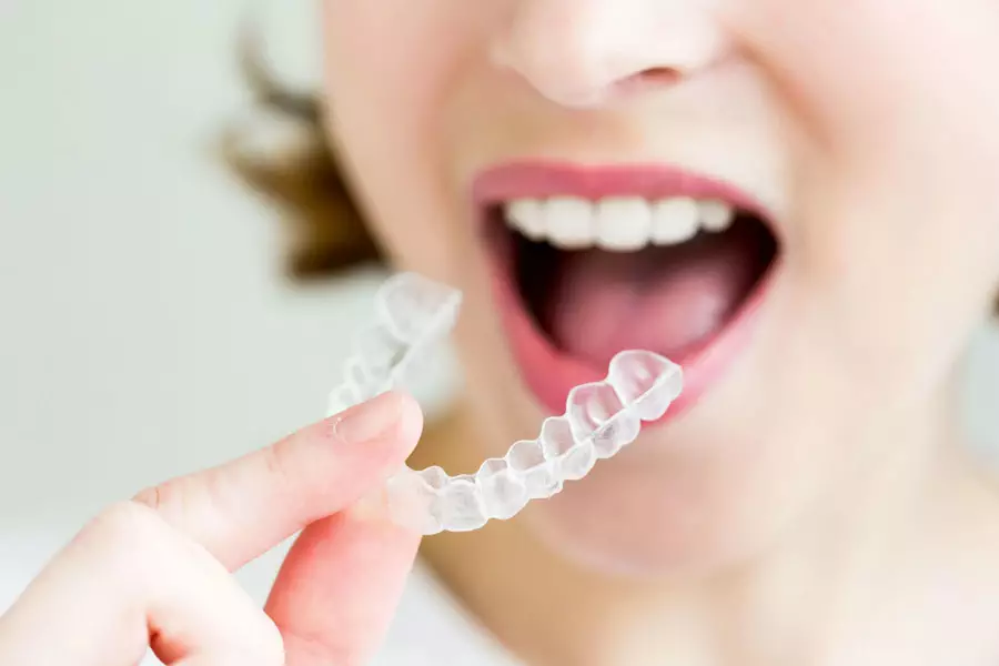 ordp invisalign-clear-braces-cost