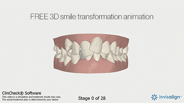 smile-transformation-animation